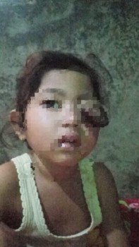 Arul Sekjen FRJRI Ucapkan Terima Kasih atas Rencana Kehadiran Bupati Tangerang untuk Jenguk Balita Penderita Tumor Ganas